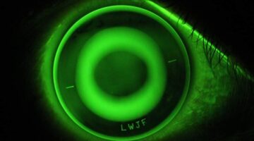 Orthokeratology (Ortho-K)